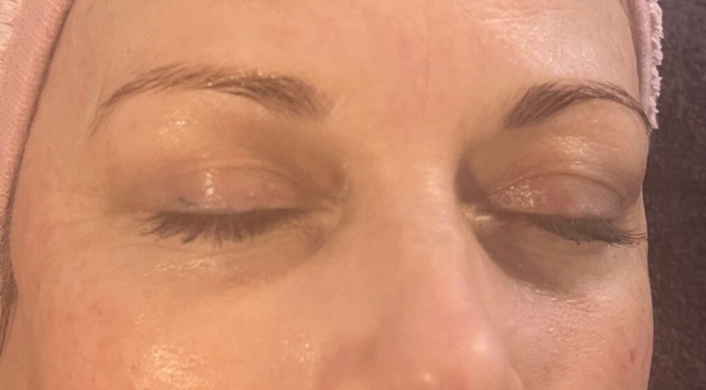 Close-up of a relaxed client post-treatment at Fresh Faces, Port Erin, Port Erin, IM. Skin appears radiant and serene.