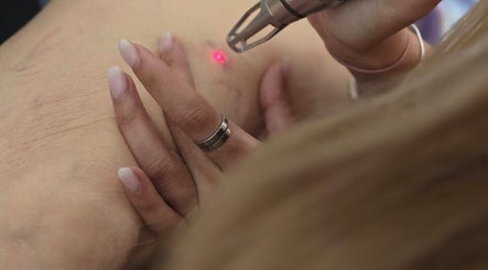Close-up of a laser treatment at Fabulaze Beauty Studio, Cape Town, Western Cape, ZA.