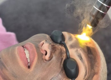 Client receiving laser facial at Fabulaze Beauty Studio, Cape Town, Western Cape, ZA.