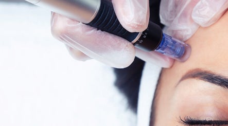 Microneedling-Behandlung bei KS Beauty Studio, Murg/Hänner, Baden-Württemberg, DE.