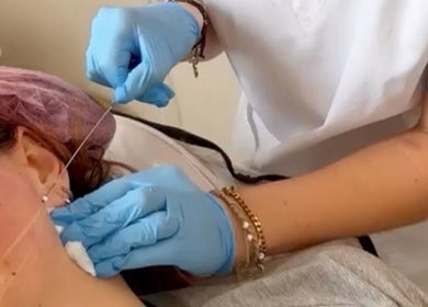 Expert facial threading at H Derma Beauti Aesthetics Norwich, ensuring smooth skin. Located in Norwich, England, GB.
