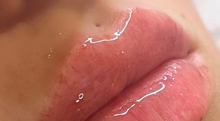 Glossy lip treatment at H Derma Beauti Aesthetics Norwich, Norwich, England, GB, showcasing plump, hydrated lips.