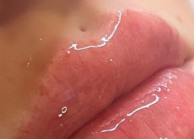 Close-up of glossy lips treatment at H Derma Beauti Aesthetics Norwich, Norwich, England, GB.