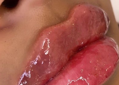 Close-up of glossy lips at H Derma Beauti Aesthetics Norwich, located in Norwich, England, GB.