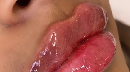 Close-up of glossy lips at H Derma Beauti Aesthetics Norwich, located in Norwich, England, GB.