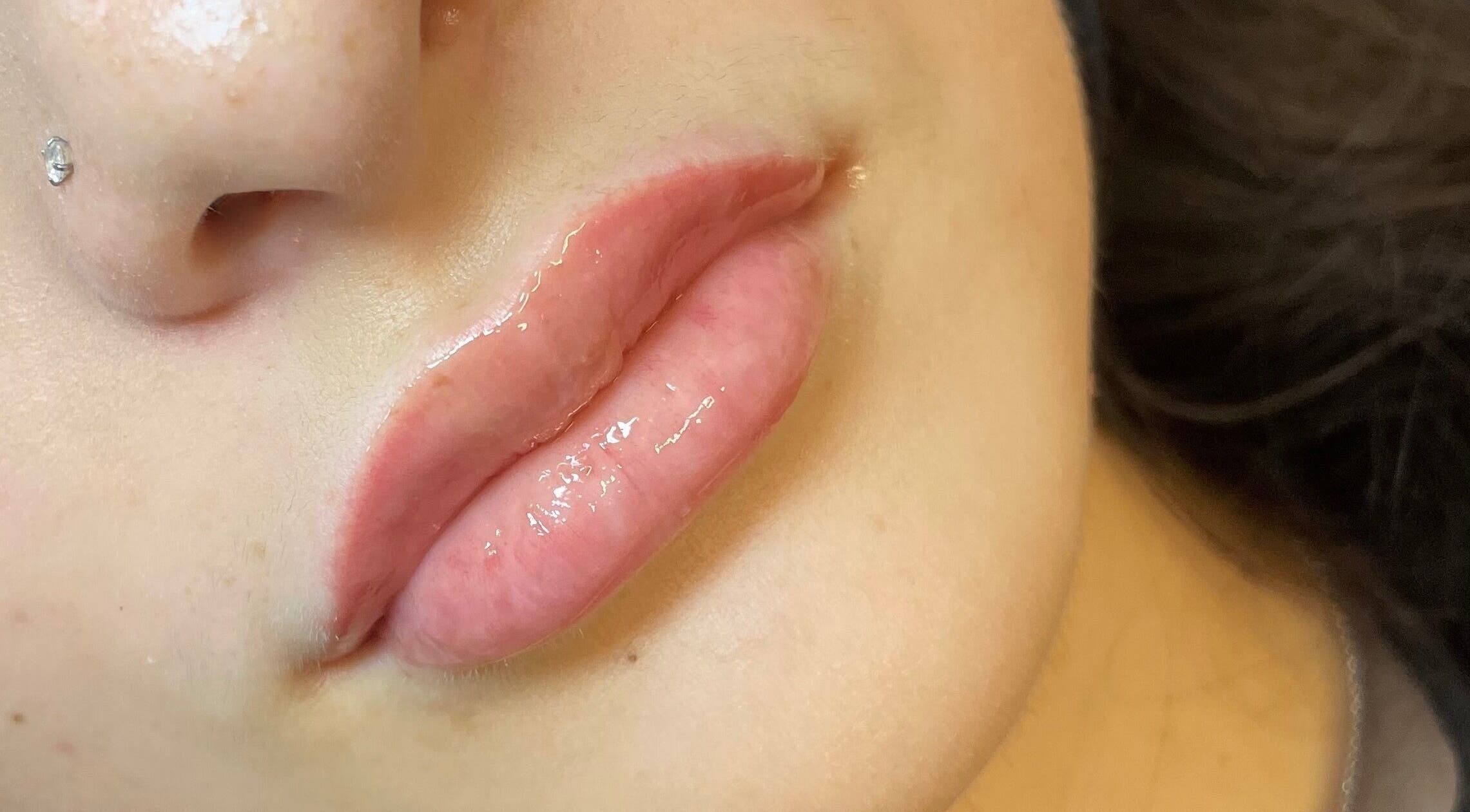 Luscious lips with gloss at Truly Aesthetically Yours, Peterborough, England, GB. Perfect results.