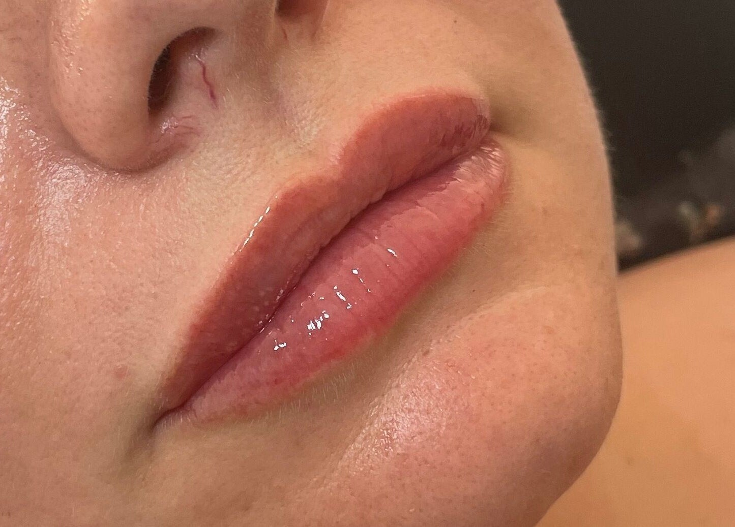 Close-up of glossy lips treatment at Truly Aesthetically Yours, Peterborough, England, GB.
