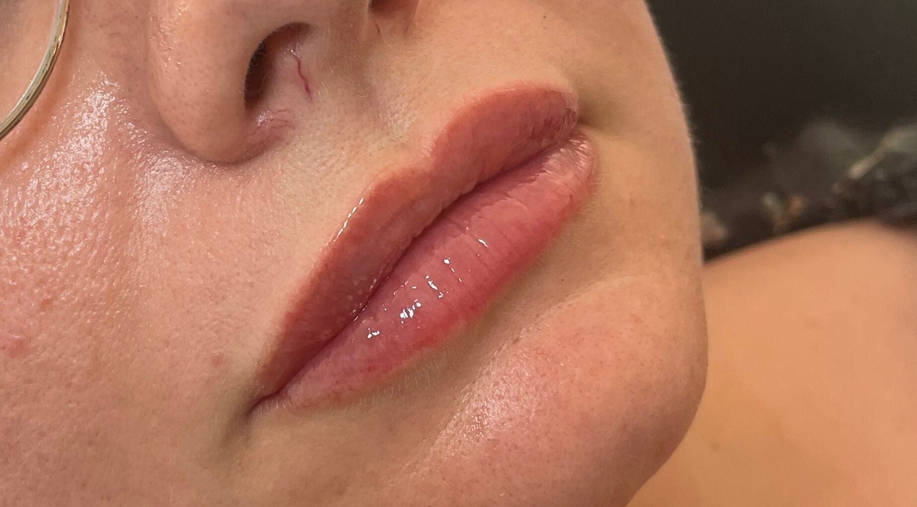 Close-up of glossy lips treatment at Truly Aesthetically Yours, Peterborough, England, GB.