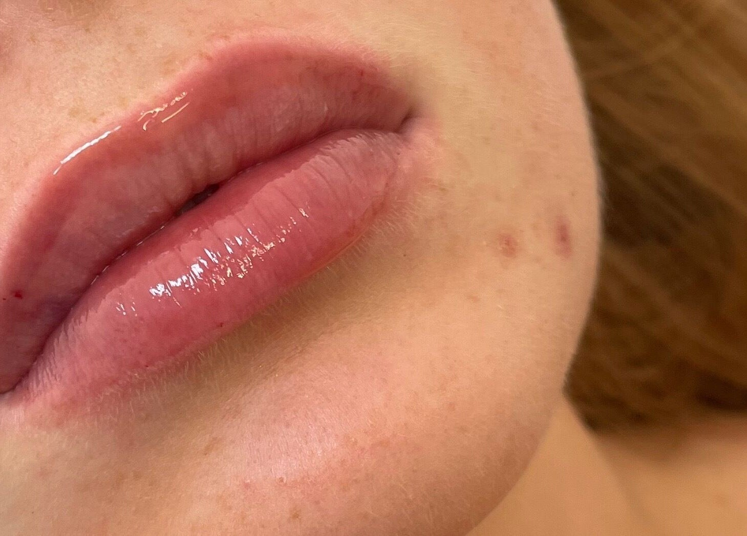 Glossy lips treatment at Truly Aesthetically Yours, Peterborough, England, GB.