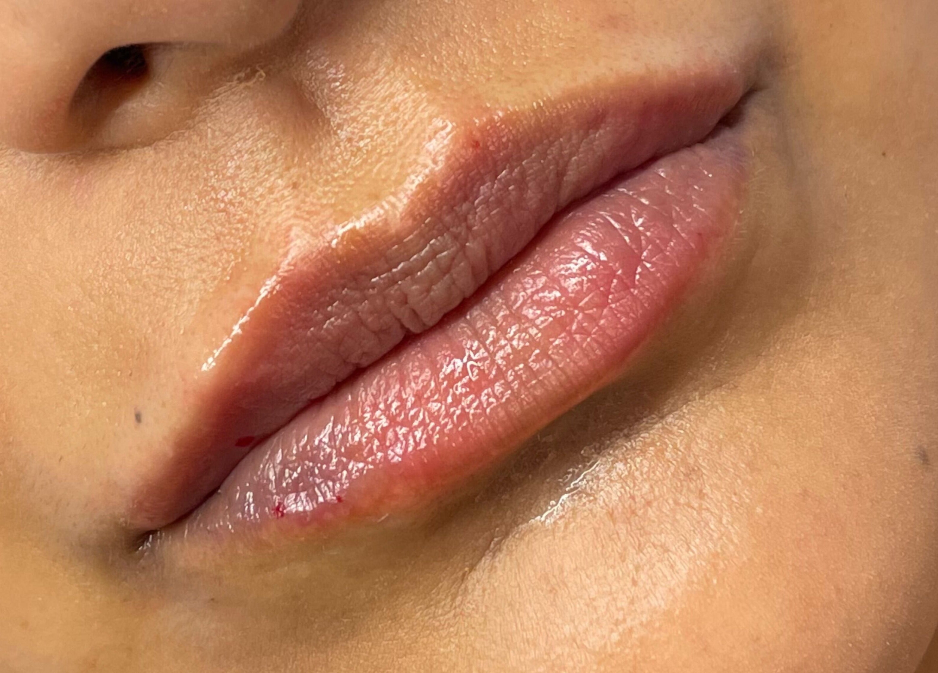 Beautifully enhanced glossy lips at Truly Aesthetically Yours, Peterborough, England, GB.