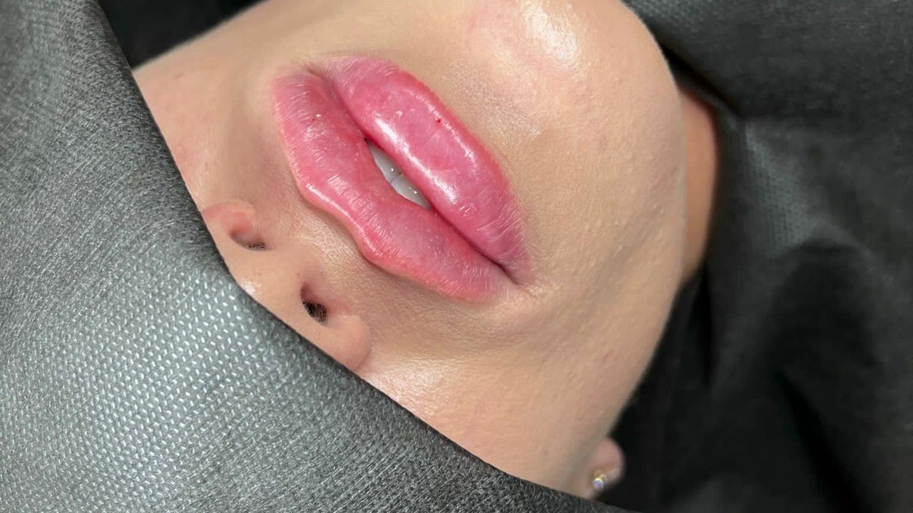 Lippen  BEAUTYCLINIC