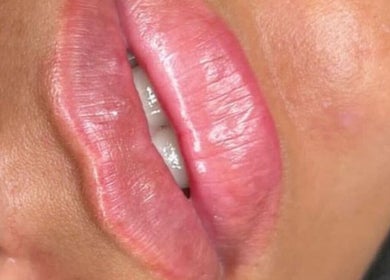 Close-up of glossy, enhanced lips at Nadia Skin And Aesthetics, Stoke-on-Trent, England, GB.