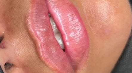 Close-up of glossy, enhanced lips at Nadia Skin And Aesthetics, Stoke-on-Trent, England, GB.