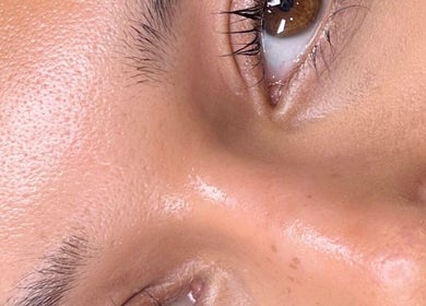 Close-up of glowing skin treatment at Nadia Skin And Aesthetics, Stoke-on-Trent, England, GB.