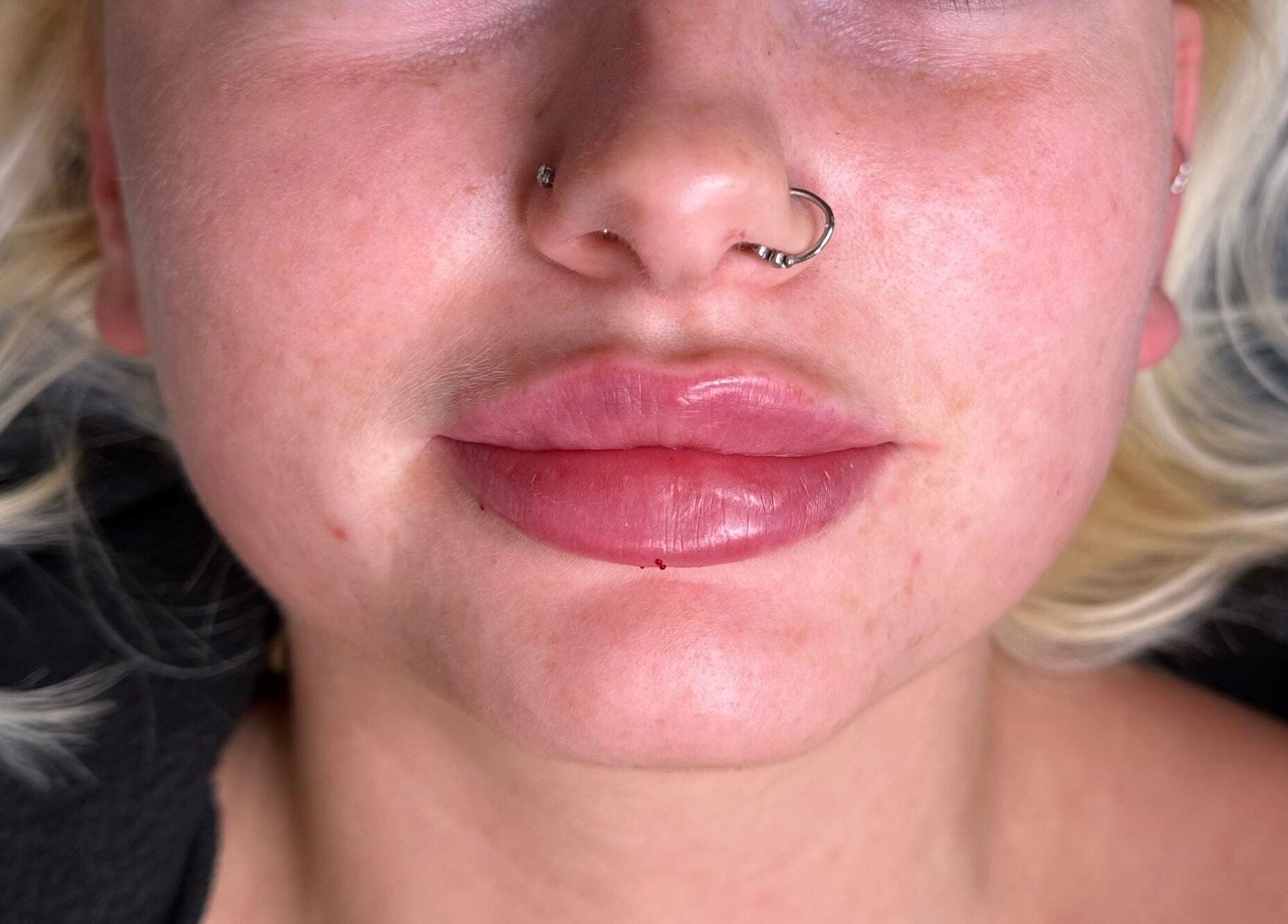 Close-up of radiant lips after treatment at Nadia Skin And Aesthetics, Stoke-on-Trent, England, GB.