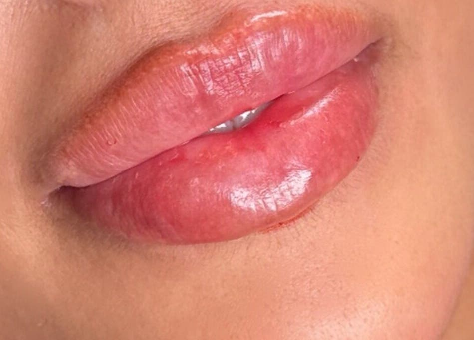 Close-up of glossy lips beauty treatment at Nadia Skin And Aesthetics, Stoke-on-Trent, England, GB.