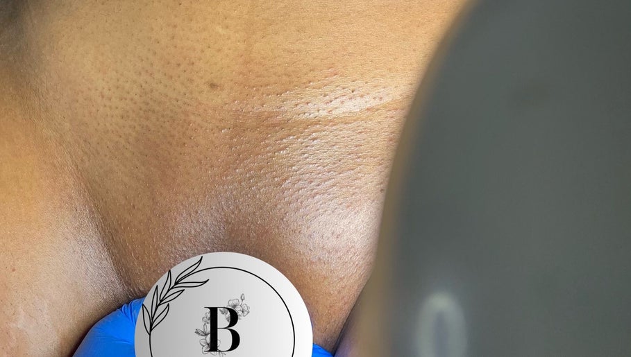 Close-up of a smooth, exfoliated back at Bare Skin Studio, St James, Port of Spain Corporation, TT.