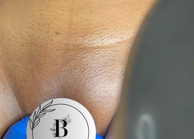 Close-up of a smooth, exfoliated back at Bare Skin Studio, St James, Port of Spain Corporation, TT.