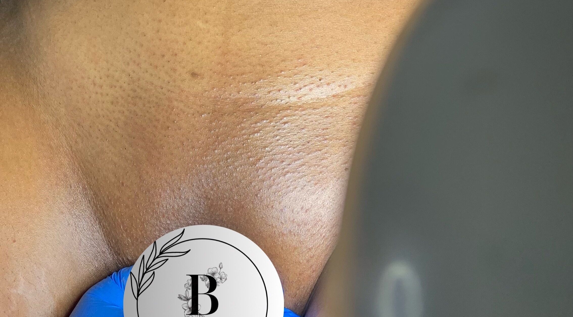 Close-up of a smooth, exfoliated back at Bare Skin Studio, St James, Port of Spain Corporation, TT.