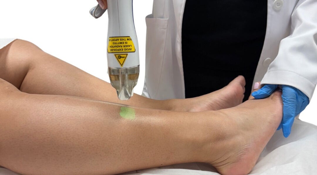 Laser hair removal at Cosmedici Laser | Rockville, ensuring smooth legs in Rockville, Maryland, US.
