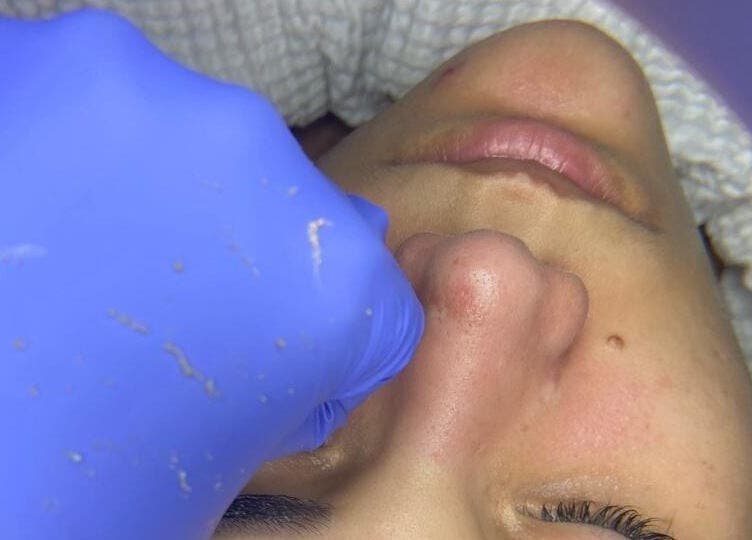 Tratamiento facial en Mia Beautes Stetic Center, Santo Domingo, Distrito Nacional, DO.