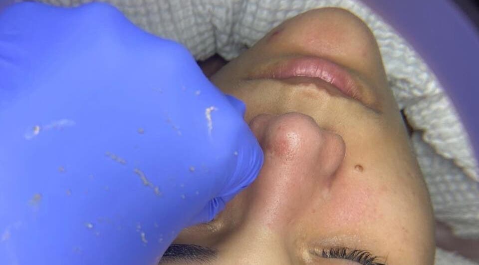 Tratamiento facial en Mia Beautes Stetic Center, Santo Domingo, Distrito Nacional, DO.