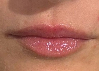 Close-up of glossy lips at InStudio Aesthetics, enhancing beauty in London, England, GB.