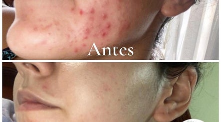 Valeria Sanchez Cosmetologia billede 2