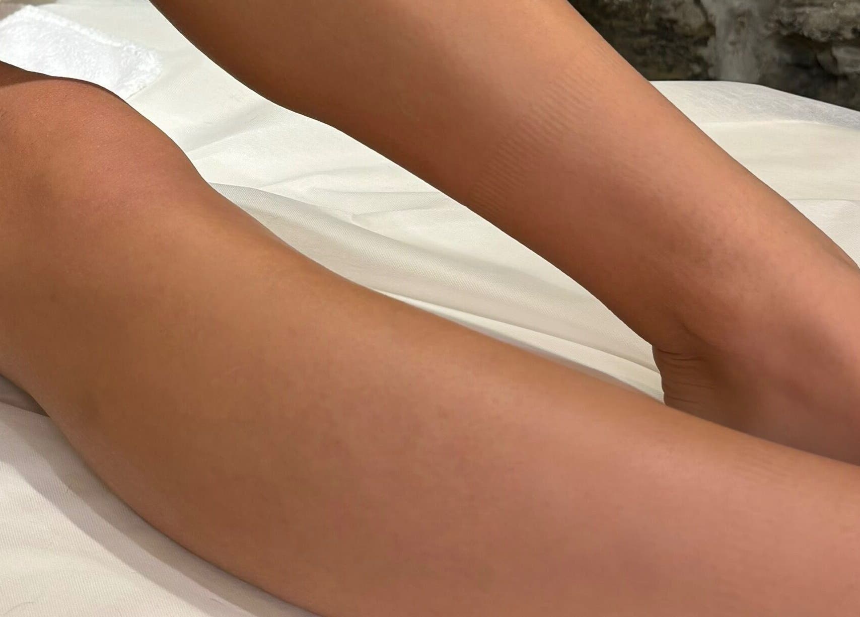 Traitement peau lisse chez ELORA Laser, Laval, Québec, CA pour une apparence impeccable.