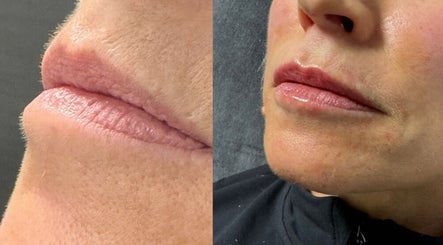 Resolve Aesthetics Stafford image 3