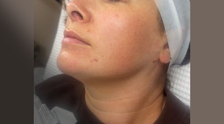 Close-up of a woman's face post-facial treatment at Serene Skin, Colwyn Bay, Wales, GB.