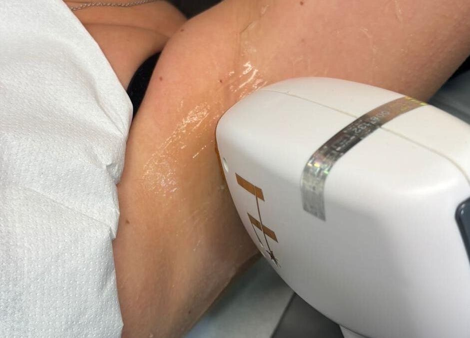 Laser hair removal at House of Boo, Petersfield, England, GB showcasing advanced technology in skincare.