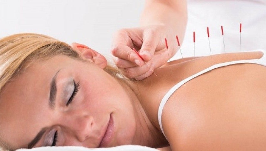 Madison Revival Within Acupuncture & Wellness, bilde 1