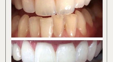 Smile Bright Teeth Whitening 3paveikslėlis