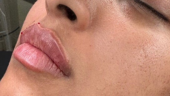 Naya Aesthetics Clinic