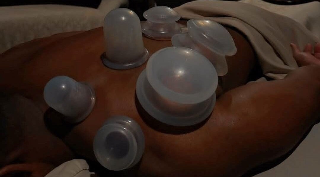 Cupping therapy on a back at James Joseph L.M.T, Houston, Texas, US, enhancing relaxation and wellness.