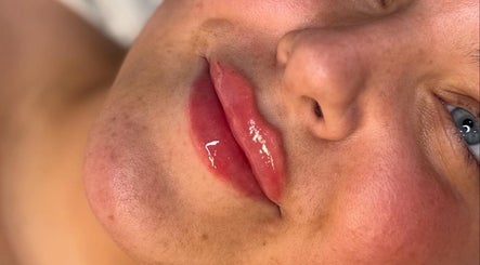 Glossy, enhanced lips at The Beauty Witch - Aesthetics, Eyebrows & Skin, Aylesbury, England, GB.