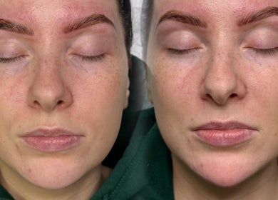 Eyebrow enhancement at The Beauty Witch - Aesthetics, Eyebrows & Skin, Aylesbury, England, GB.