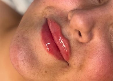 Luscious lips shine brightly after treatment at The Beauty Witch - Aesthetics, Eyebrows & Skin, Aylesbury, England, GB.
