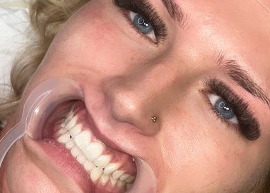 Close-up of a woman undergoing a dental procedure at CSLashes, Bournemouth, England, GB.