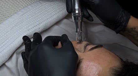 Microneedling facial at Nataly Evo, Cannes, Provence-alpes-côte D'azur, FR for youthful skin.