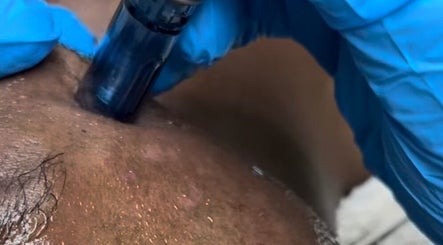 HydraFacial skin treatment at JustGridzSkins, Pretoria, Gauteng, ZA, promotes hydration and rejuvenation.