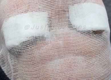 Facial treatment at JustGridzSkins, Pretoria, Gauteng, ZA, with soothing gauze wrap on a relaxed face.