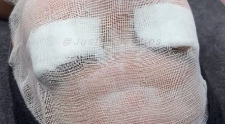Facial treatment at JustGridzSkins, Pretoria, Gauteng, ZA, with soothing gauze wrap on a relaxed face.