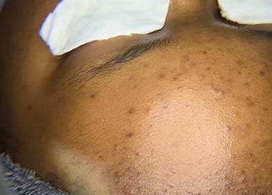Close-up of facial treatment at JustGridzSkins in Pretoria, Gauteng, ZA, showcasing skincare expertise.