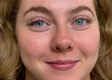 A person with clear skin and bright eyes at Simply Stunning, London, England, GB showcasing natural beauty.