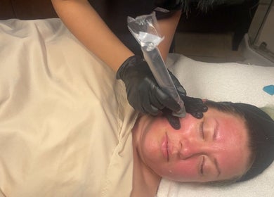 Facial treatment at The Makeup Monk in Costa Mesa, California, US. Aesthetician using a tool on a client's face.