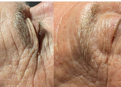 Close-up of skin before and after treatment at The Makeup Monk, Costa Mesa, California, US.