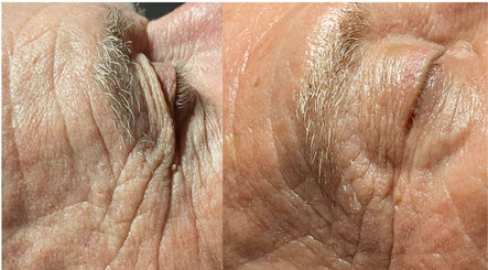 Close-up of skin before and after treatment at The Makeup Monk, Costa Mesa, California, US.