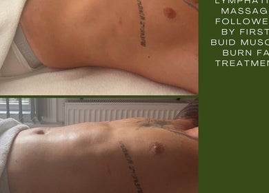 Lymphatic massage and muscle treatment at M Sculpt in Southampton, England, GB. Achieve wellness and relaxation.